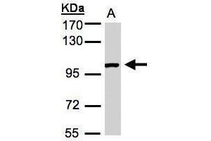 WB Image Sample (30μg whole cell lysate) A:A431, 7. (ABR Antikörper  (C-Term))