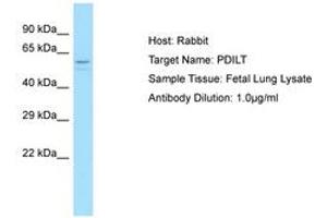 Image no. 1 for anti-Protein Disulfide Isomerase-Like, Testis Expressed (PDILT) (C-Term) antibody (ABIN6750221) (PDILT Antikörper  (C-Term))