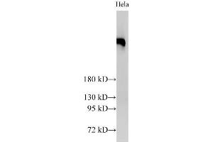 Western Blot analysis of Hela cells using BRCA2 Polyclonal Antibody at dilution of 1:2000