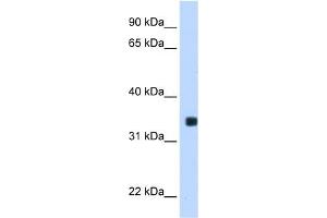 WB Suggested Anti-MLX Antibody Titration:  0. (MLX Antikörper  (C-Term))