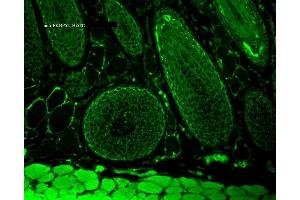 Immunohistochemistry (IHC) image for anti-FK506 Binding Protein 4, 59kDa (FKBP4) antibody (ABIN361687)