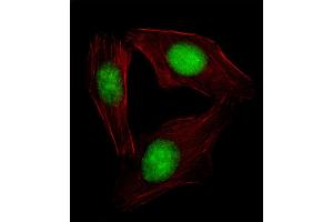 Fluorescent image of  cell stained with SREBF2 Antibody (Center) (ABIN654630 and ABIN2844326). (SREBF2 Antikörper  (AA 399-427))