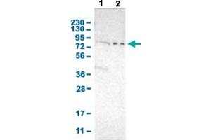 Western Blot analysis with PKP2 polyclonal antibody . (Plakophilin 2 Antikörper  (AA 72-194))