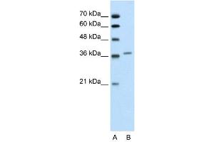 WB Suggested Anti-ALAD  Antibody Titration: 0. (ALAD Antikörper  (Middle Region))