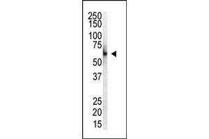 Image no. 1 for anti-Protein Inhibitor of Activated STAT, 4 (PIAS4) (N-Term) antibody (ABIN356770) (PIAS4 Antikörper  (N-Term))