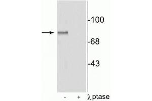 Western blot of rat brain lysate showing specific immunolabeling of the ~87 kDa MARCKS protein phosphorylated at Ser152,156, in the first lane (-). (MARCKS Antikörper  (pSer152, pSer156))