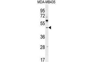 Western Blotting (WB) image for anti-Activating Transcription Factor 4 (Tax-Responsive Enhancer Element B67) (ATF4) (AA 170-198), (Middle Region) antibody (ABIN950550)