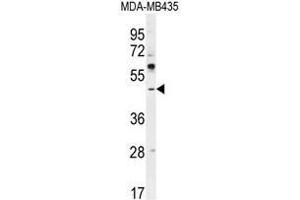 ATF4 Antibody (Center) western blot analysis in MDA-MB435 cell line lysates (35µg/lane). (ATF4 Antikörper  (Middle Region))