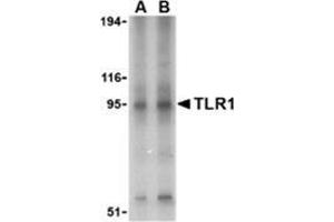 Western blot analysis of TLR1 in Daudi cell lysate with this product at (A) 1 and (B) 2 μg/ml. (TLR1 Antikörper  (Center))
