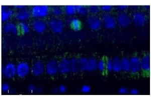Immunofluorescence (IF) image for anti-Tubulin, beta (TUBB) antibody (ABIN619536) (TUBB Antikörper)