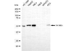 Western blotting analysis using TRIM65 antibody (ABIN7800641). (TRIM65 Antikörper)