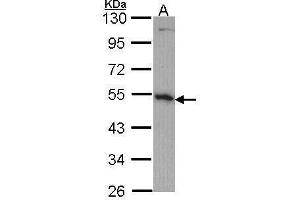 WB Image Sample (30 ug of whole cell lysate) A: H1299 10% SDS PAGE OST48 antibody antibody diluted at 1:1000 (DDOST Antikörper  (Center))