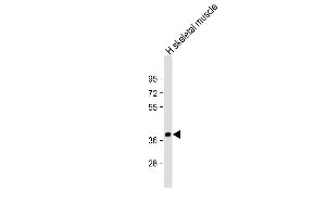 Anti-TRIB1 Antibody C-term at 1:2000 dilution + human skeletal muscle lysate Lysates/proteins at 20 μg per lane. (TRIB1 Antikörper  (C-Term))