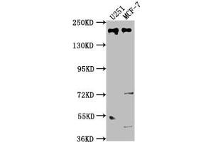 Western Blot Positive WB detected in: U251 whole cell lysate, MCF-7 whole cell lysate All lanes: UNC13B antibody at 1:2000 Secondary Goat polyclonal to rabbit IgG at 1/50000 dilution Predicted band size: 181, 183 kDa Observed band size: 181 kDa (UNC13B Antikörper  (AA 12-215))