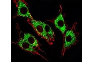 Fluorescent image of PC12 cells stained with Pink1 antibody. (PINK1 Antikörper)