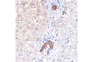 Immunohistochemistry of paraffin-embedded human liver using p53 DINP1 Rabbit mAb (ABIN7271097) at dilution of 1:100 (40x lens). (TP53INP1 Antikörper)