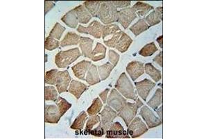 MTX2 Antibody (C-term) (ABIN654751 and ABIN2844433) immunohistochemistry analysis in formalin fixed and paraffin embedded human skeletal muscle followed by peroxidase conjugation of the secondary antibody and DAB staining.
