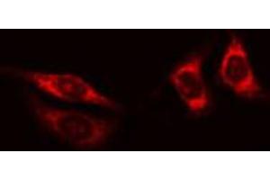 ABIN6268946 staining HT29 cells by IF/ICC. (TXNRD2 Antikörper  (C-Term))