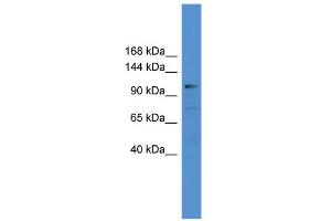 WB Suggested Anti-USP35 Antibody Titration: 0. (USP35 Antikörper  (C-Term))