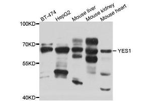 Western blot analysis of extracts of 293 cell line, using YES1 antibody.