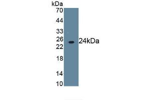 Detection of Recombinant FcgR3B, Human using Monoclonal Antibody to Fc Fragment Of IgG Low Affinity IIIb Receptor (FcgR3B)