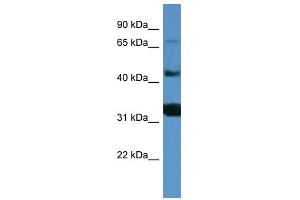 Western Blot showing MFI2 antibody used at a concentration of 1-2 ug/ml to detect its target protein.