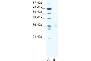 Human Jurkat; WB Suggested Anti-LHX3 Antibody. (LHX3 Antikörper  (Middle Region))
