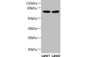 Western blot All lanes: GALNT15 antibody at 5 μg/mL Lane 1: Mouse liver tissue Lane 2: Mouse kidney tissue Secondary Goat polyclonal to rabbit IgG at 1/10000 dilution Predicted band size: 74 kDa Observed band size: 74 kDa (GALNT14 Antikörper  (AA 35-335))