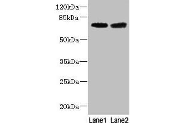 GALNT14 Antikörper  (AA 35-335)