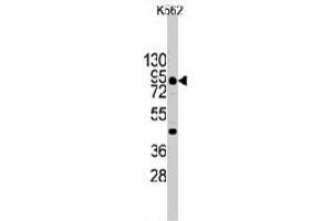 Western blot analysis of CDH3 (arrow) using rabbit CDH3 polyclonal antibody  in K-562 cell line lysates (35 ug/lane). (P-Cadherin Antikörper  (C-Term))