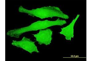 Immunofluorescence of monoclonal antibody to USP10 on HeLa cell. (USP10 Antikörper  (AA 699-797))