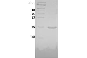 Western Blotting (WB) image for Leptin (LEP) (AA 22-167) protein (His tag) (ABIN7123742) (Leptin Protein (LEP) (AA 22-167) (His tag))