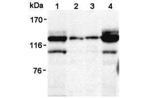 Western Blotting (WB) image for anti-Signal-Induced Proliferation-Associated 1 (SIPA1) antibody (ABIN1449260) (SIPA1 Antikörper)