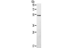 Western Blotting (WB) image for anti-serine/threonine/tyrosine Kinase 1 (STYK1) antibody (ABIN2427348) (STYK1 Antikörper)