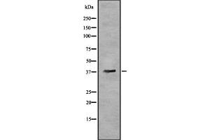 Western blot analysis OR5T3 using HeLa whole cell lysates (OR5T3 Antikörper)