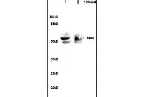 Lane 1: rat brain lysates Lane 2: human colon carcinoma lysates probed with Anti A1BG Polyclonal Antibody, Unconjugated  at 1:200 in 4˚C. (A1BG Antikörper  (AA 301-400))