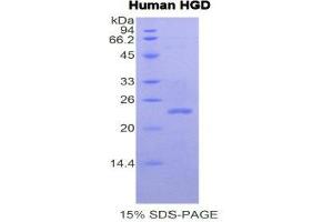 SDS-PAGE (SDS) image for Homogentisate 1,2-Dioxygenase (HGD) (AA 239-428) protein (His tag) (ABIN2121261)