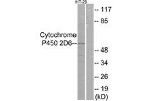 Western blot analysis of extracts from HT-29 cells, using Cytochrome P450 2D6 Antibody. (CYP2D6 Antikörper  (AA 251-300))