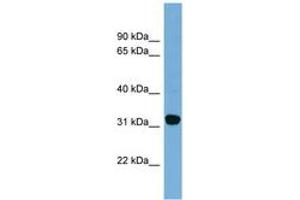 Image no. 1 for anti-Carbonyl Reductase 1 (CBR1) (AA 107-156) antibody (ABIN6744809) (CBR1 Antikörper  (AA 107-156))