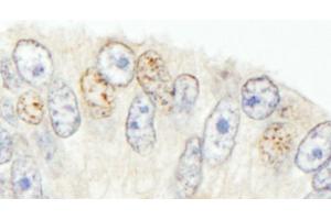 anti-SNW Domain Containing 1 (SNW1) (AA 450-500) antibody
