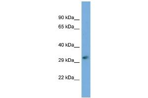 Host:  Rabbit  Target Name:  FKTN  Sample Type:  721_B Whole cell lysates  Antibody Dilution:  1. (Fukutin Antikörper  (C-Term))