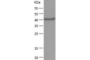 Western Blotting (WB) image for Aminoacylase 1 (ACY1) (AA 1-408) protein (His tag) (ABIN7121810)