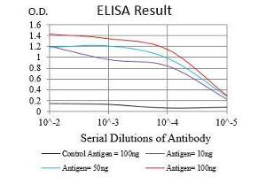 Black line: Control Antigen (100 ng), Purple line: Antigen(10 ng), Blue line: Antigen (50 ng), Red line: Antigen (100 ng), (Nibrin Antikörper  (AA 467-615))