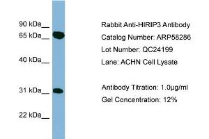 WB Suggested Anti-HIRIP3  Antibody Titration: 0. (HIRIP3 Antikörper  (Middle Region))