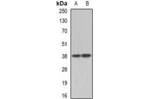 Western blot analysis of TEL2 expression in A431 (A), Hela (B) whole cell lysates. (ETV7 Antikörper)