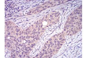 Immunohistochemistry (IHC) image for anti-TNF Receptor-Associated Factor 2 (TRAF2) (AA 39-188) antibody (ABIN5896378) (TRAF2 Antikörper  (AA 39-188))
