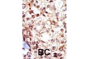 Immunohistochemistry (IHC) image for anti-Gardner-Rasheed Feline Sarcoma Viral (V-Fgr) Oncogene Homolog (FGR) antibody (ABIN3003443)