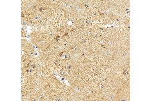 anti-Vesicle-Associated Membrane Protein 4 (VAMP4) (AA 1-118) antibody