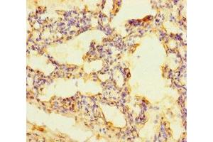 Immunohistochemistry of paraffin-embedded human lung tissue using ABIN7168465 at dilution of 1:100 (RUFY4 Antikörper  (AA 174-473))