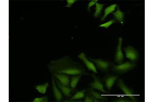 Immunofluorescence of purified MaxPab antibody to CDADC1 on HeLa cell. (CDADC1 Antikörper  (AA 1-514))